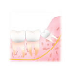 親知らず.jpg 親知らず.jpg